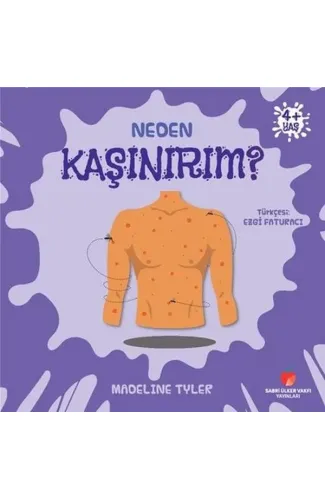 Neden Kaşınırım