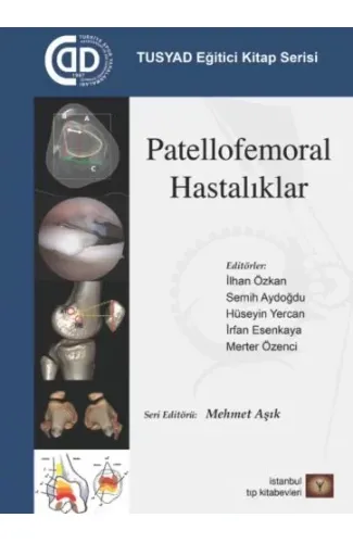 TUSYAD Eğitici Kitap Serisi - Patellofemoral Hastalıklar